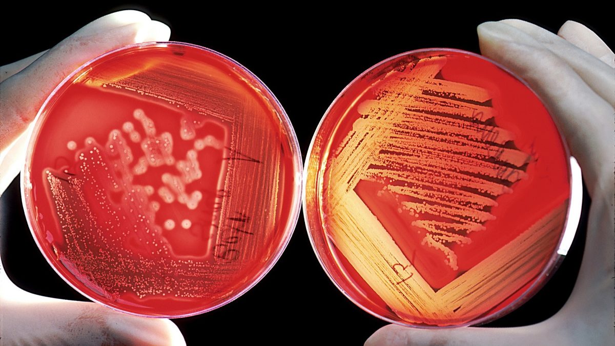 Zwei Hände mit weißen Handschuhen zeigen Bakterien in roten Aufbewahrungsgläsern