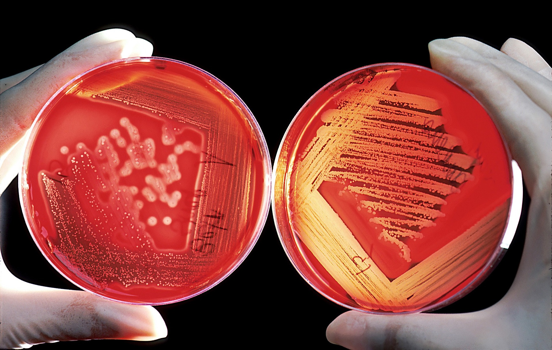 Zwei Hände mit weißen Handschuhen zeigen Bakterien in roten Aufbewahrungsgläsern